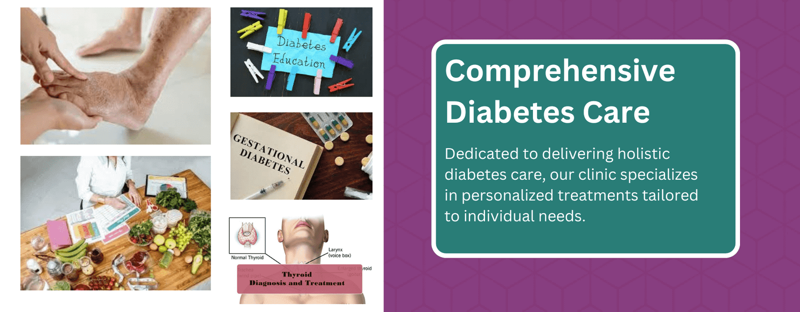 Comprehensive diabetes complication assessment