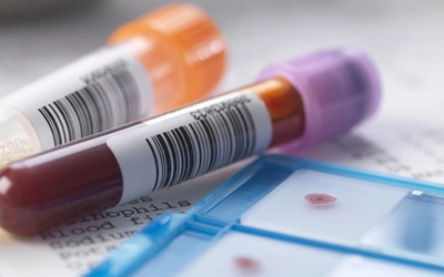 CD4 & Viral Load Testing