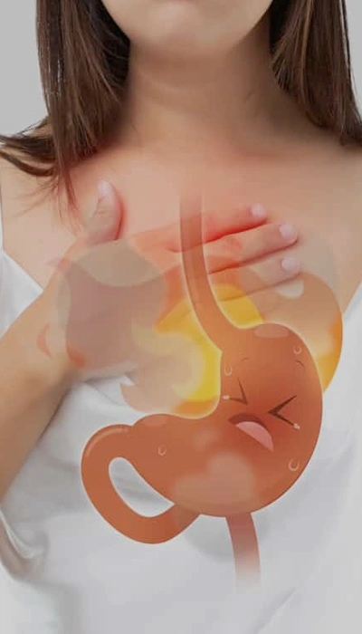 Burning feeling in the chest Gastroesophageal Reflux Disease (GERD) treatment