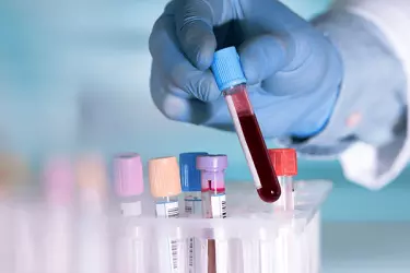 Pathology and diabetes laboratory testing