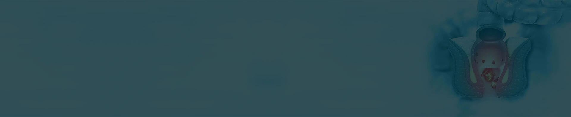 Piles Treatment in Delhi | Piles Doctor Near Me | Dr. Monga's