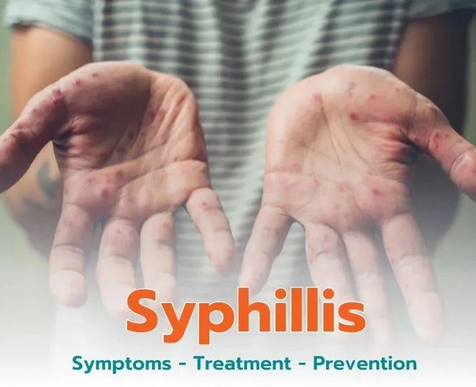 syphilis causes symptoms prevention and treatment
