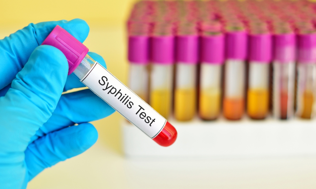 syphilis test